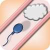 Infertility - Vas Deferens Blockage