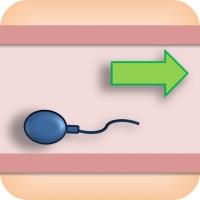 Retrograde ejaculation: sperm going into the bladder instead of being ejaculated