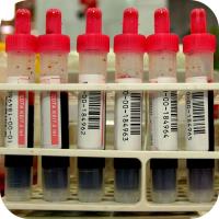 Fertility Blood Tests Test Tubes