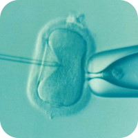 Intracytoplasmic Sperm Injection (ICSI)