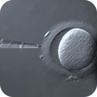 Egg cell being injected with gamete head